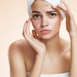 Ayurvedic Acne Cream Manufacturers in India