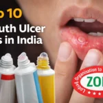 Top Mouth Ulcer Gels in India
