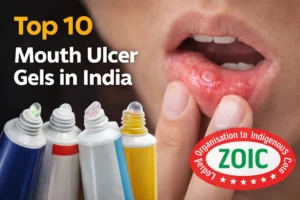 Top Mouth Ulcer Gels in India